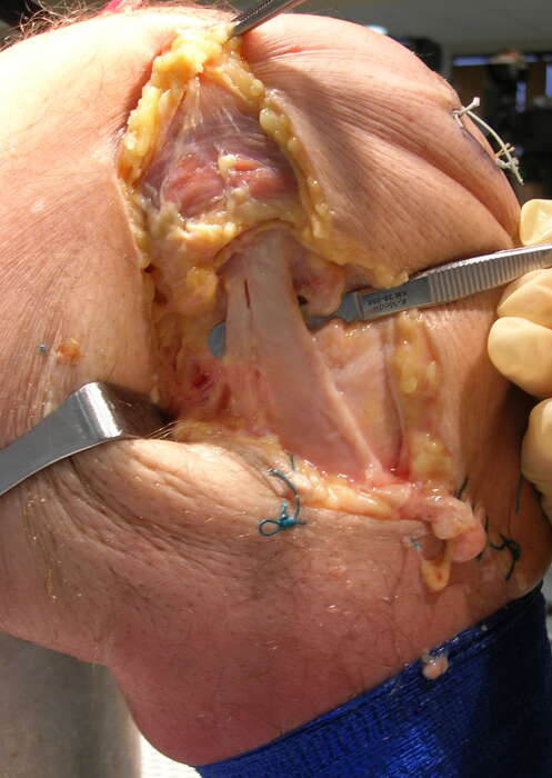 Foto Cadaver lab:  Anatomia settoria per i professionisti della riabilitazione - MODULO GINOCCHIO 