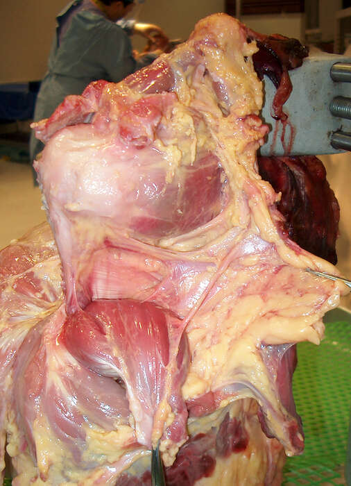 Foto Cadaver lab:  Anatomia settoria per i professionisti della riabilitazione - MODULO SPALLA 
